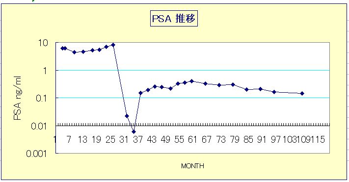 PSA推移図